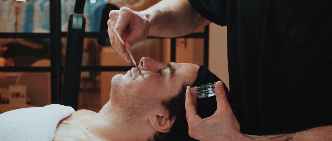 Microneedling Face Treatment +Resurfacing Peel Enhancement: targeted skin renewal through advanced combination therapy