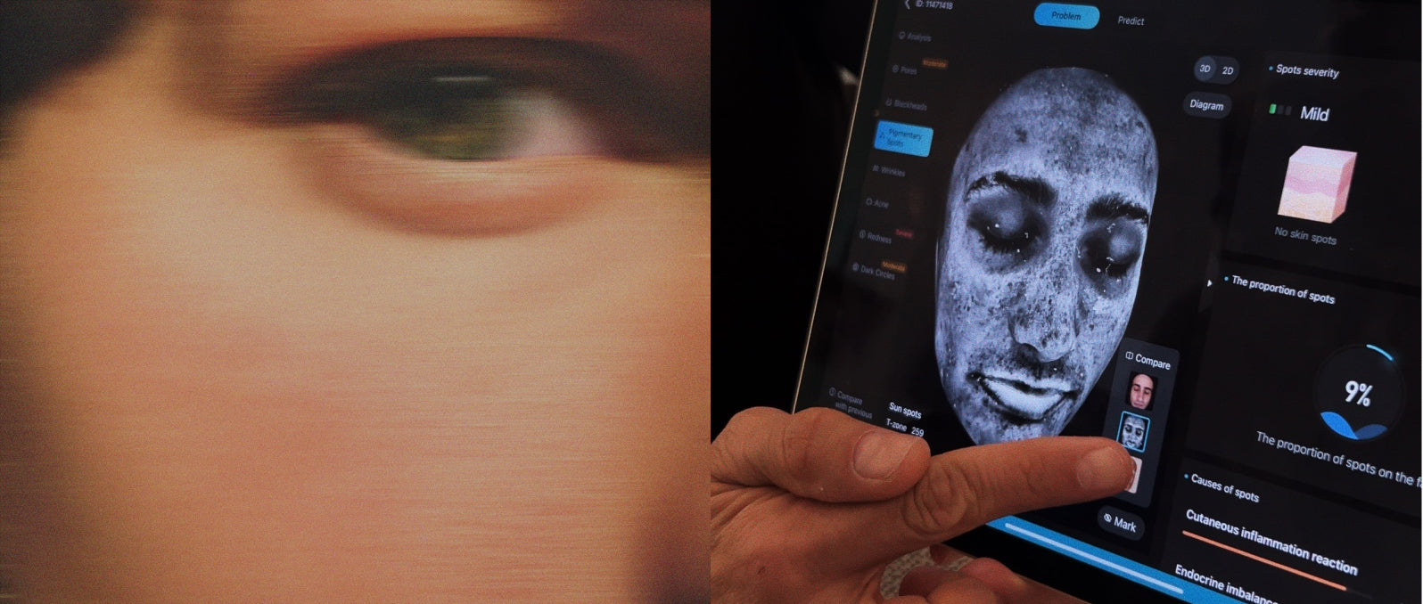 Unlocking deeper skin insights with AI-powered technology