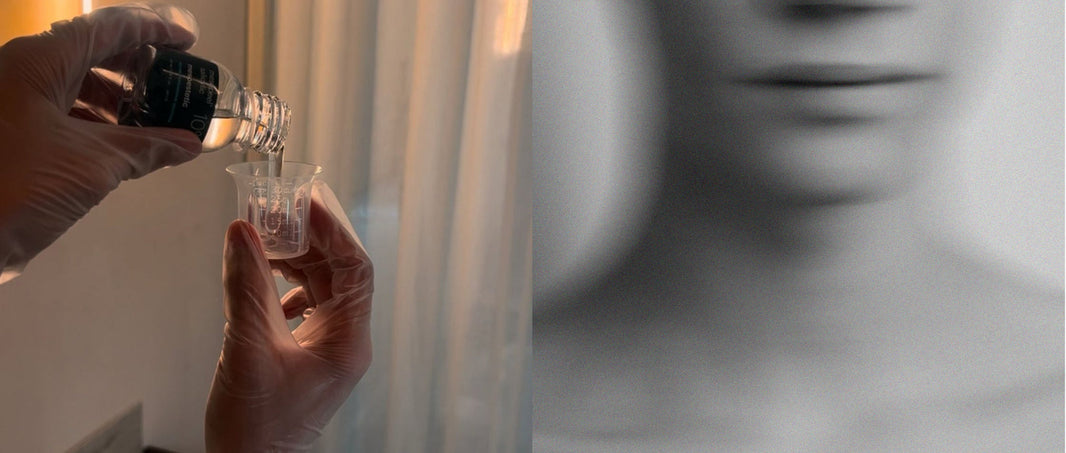 Chemical peel treatment: improve skin texture, reduce pigmentation & boost rejuvenation