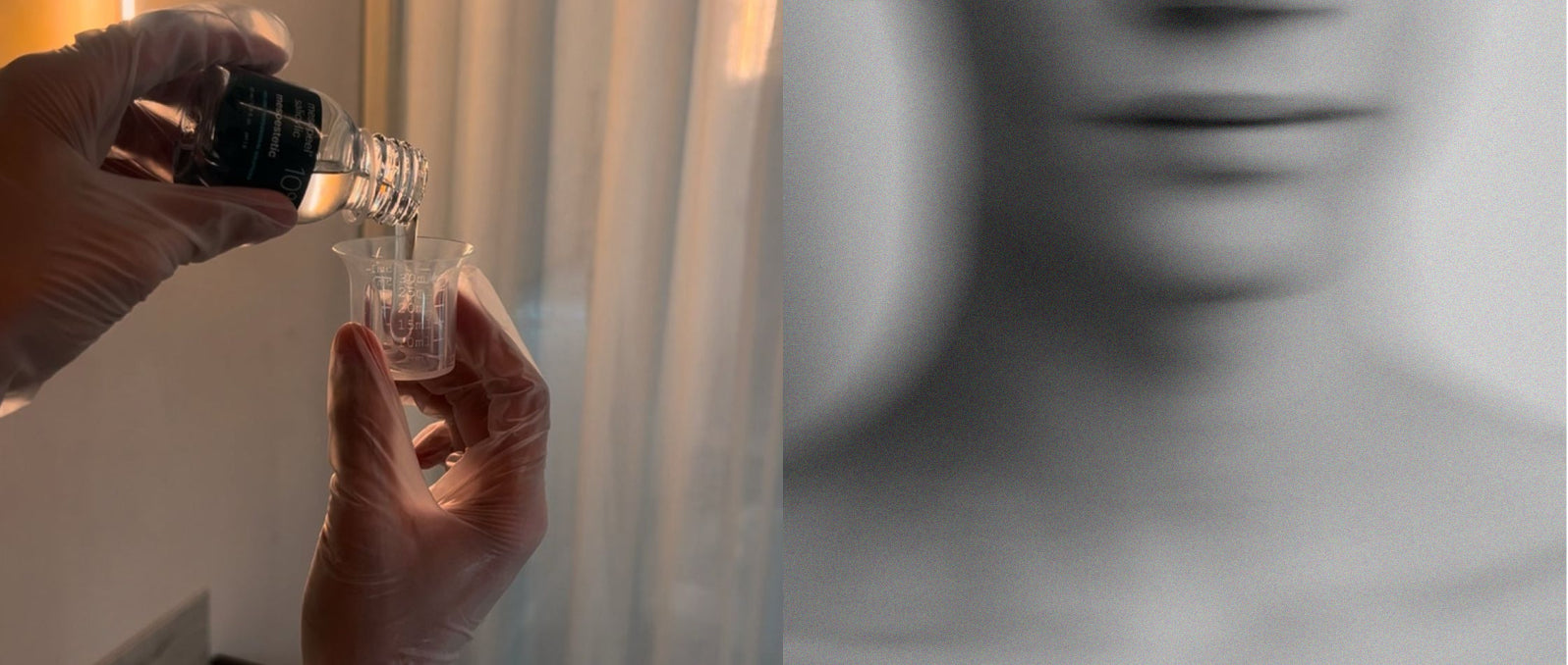 Chemical peel treatment: improve skin texture, reduce pigmentation & boost rejuvenation